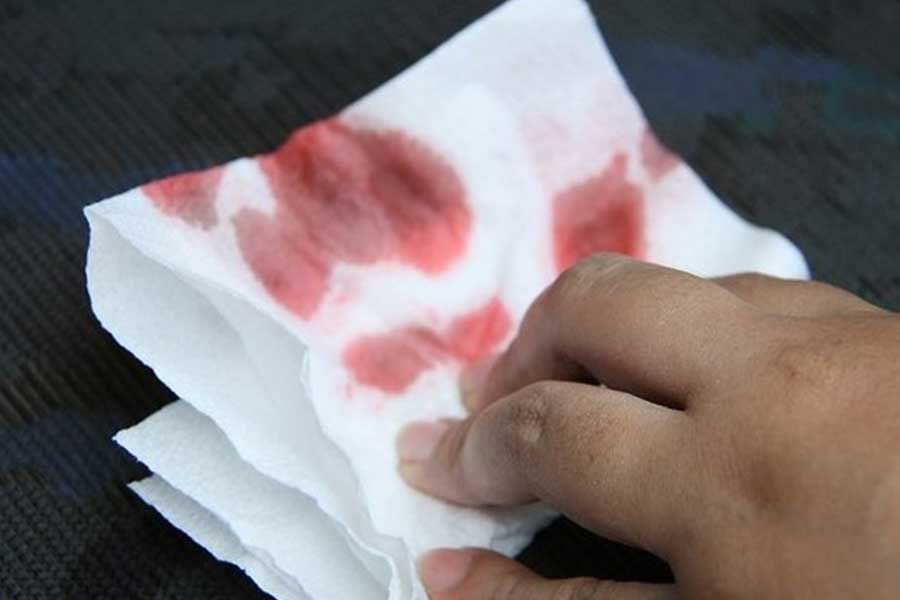 How to Remove Blood Stains from Car Seats